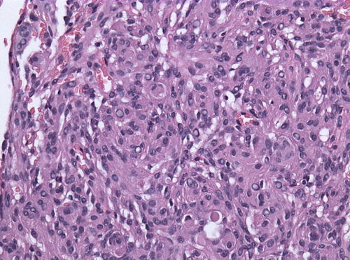 Neuropathology case III - 03.jpg