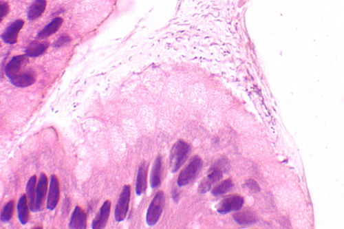 Helicobacter gastritis - crop -- extremely high mag.jpg