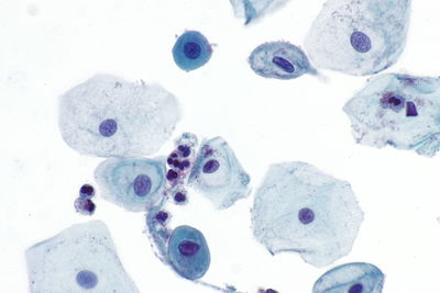 Parabasal cells - Pap test -- very high mag.jpg