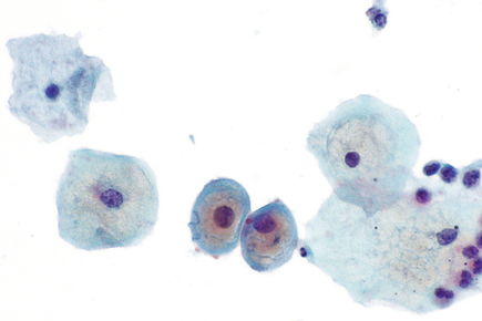 Navicular cells -- very high mag.jpg