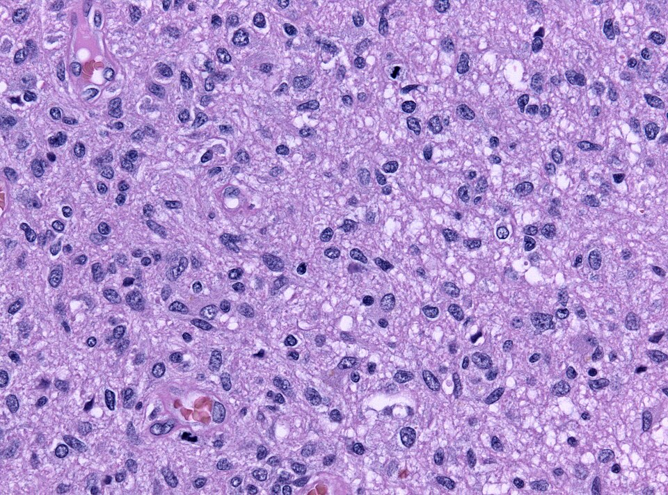 File:Mitoses astro III.jpg