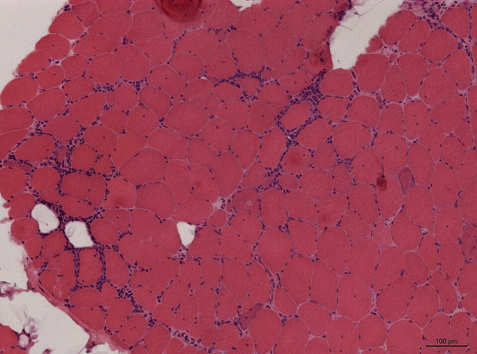 File:Neuropathology case XII 01.jpg