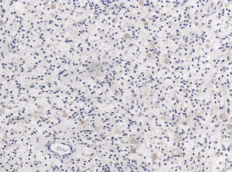 File:Neuropathology case IX.jpg