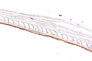 Fecal material - Libre Pathology