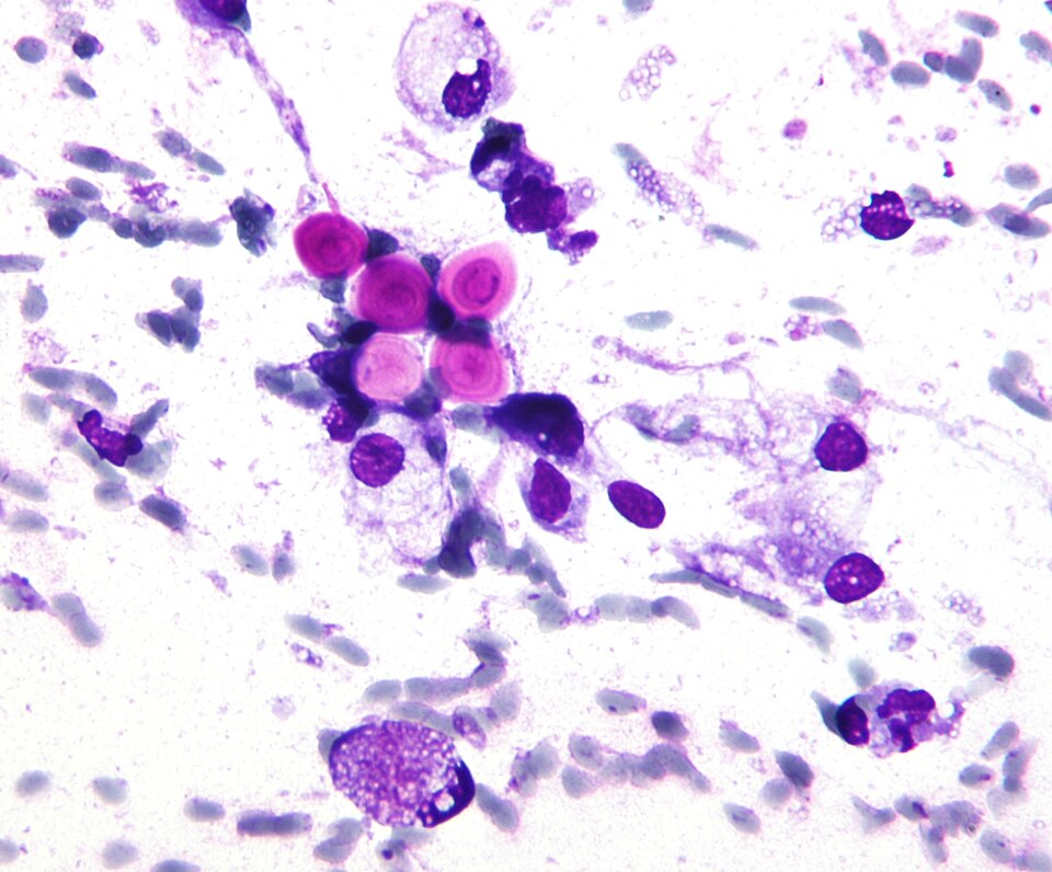 File:Cryptococcus.jpg