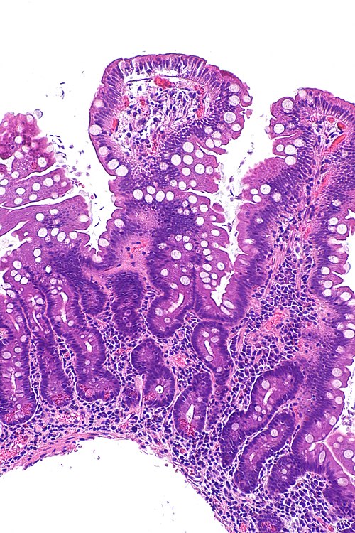 Giardia small bowel -- intermed mag.jpg