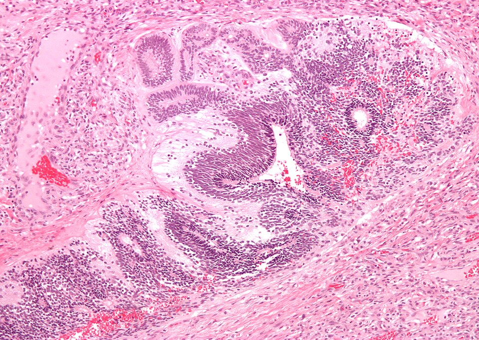 File:Primitive neuroepithelium intermed mag.jpg