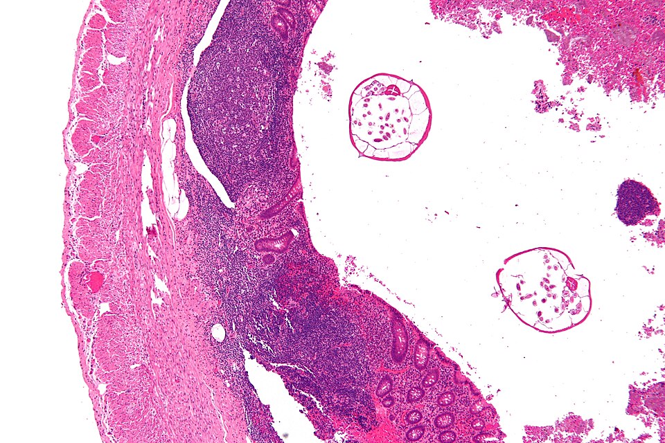 File:Enterobius - low mag.jpg