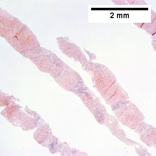 Fibrous bands dissect hepatocyte nodules (Row 1 Left 20X).