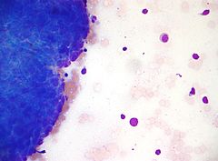 Cytopathology - Libre Pathology