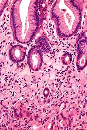 Veterinary Sciences | Free Full-Text | Canine Gastric Cancer: Current  Treatment Approaches