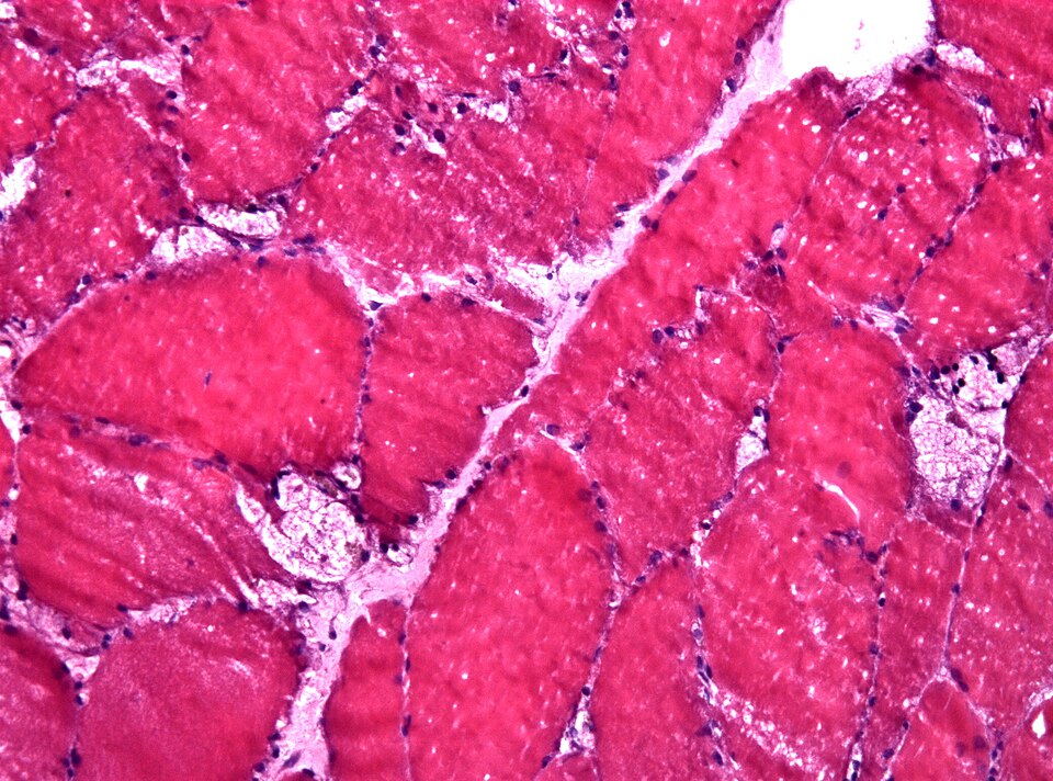 File:Pompe vacuoles.jpg