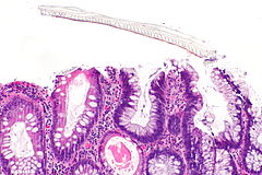 Fecal material - Libre Pathology