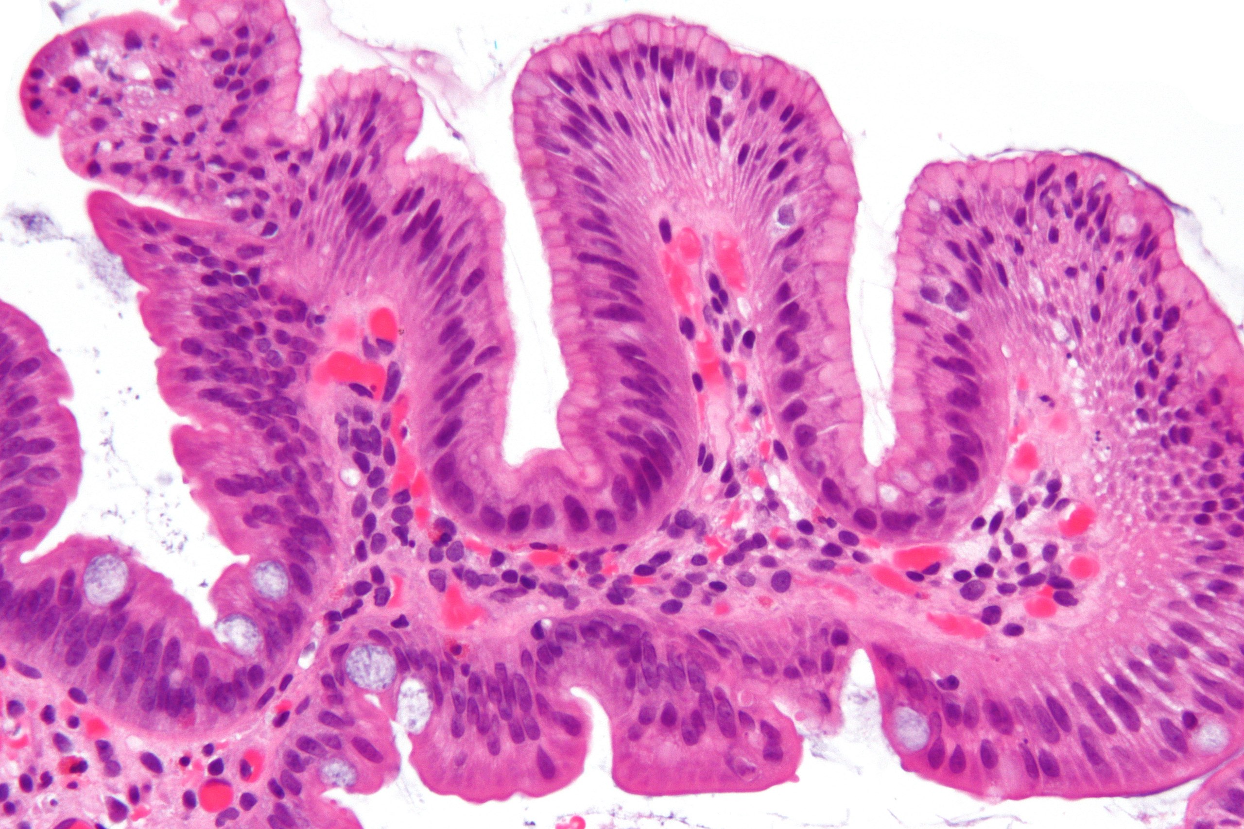 Fileduodenum With Foveolar Metaplasia Alt Very High Mag Libre Pathology