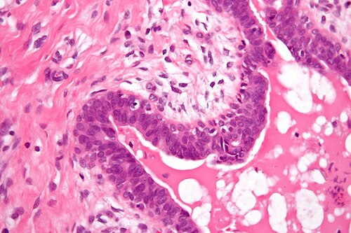 Gynecomastoid hyperplasia - very high mag.jpg