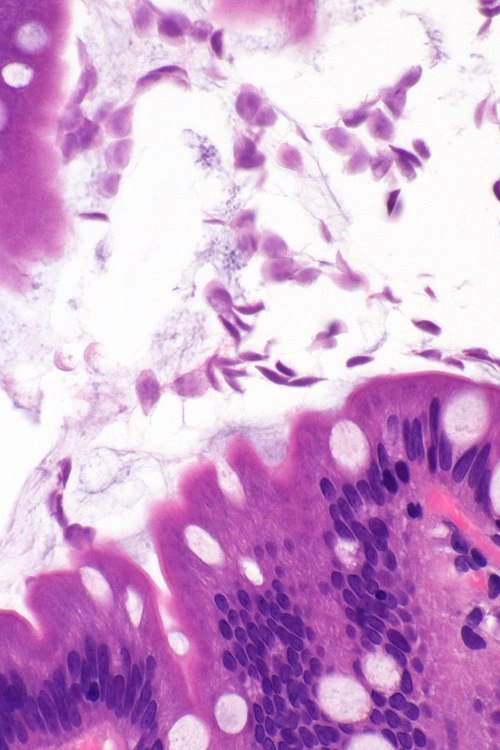Giardia small bowel -- very high mag.jpg
