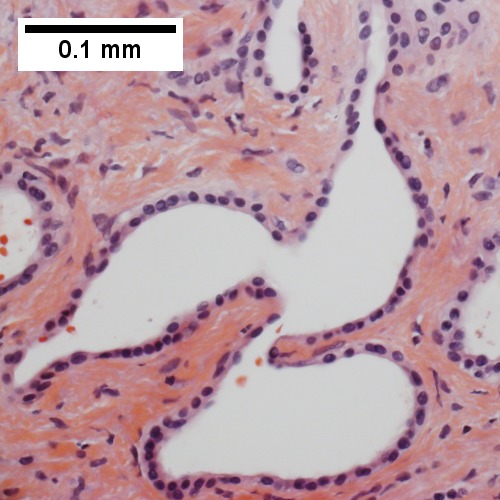 Bland epithelial linings (400X).