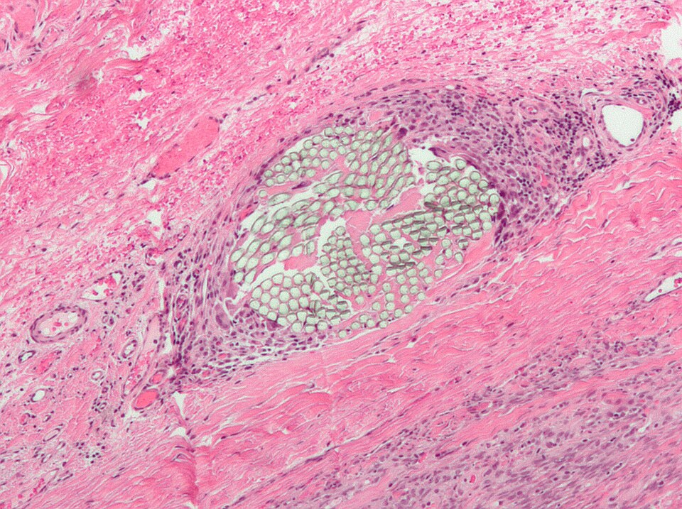 File:Suture micrograph.jpg