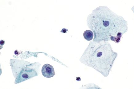 Parabasal cells - Pap test - 2 -- very high mag.jpg