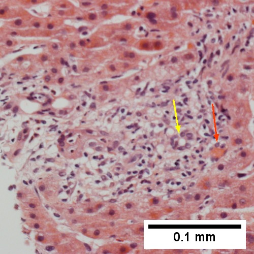 Uninflamed interlobular duct (yellow arrow) with, accompanying blood vessel (red arrow) (400X)