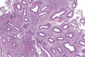 Endometrium histology proliferative Menestral Phase