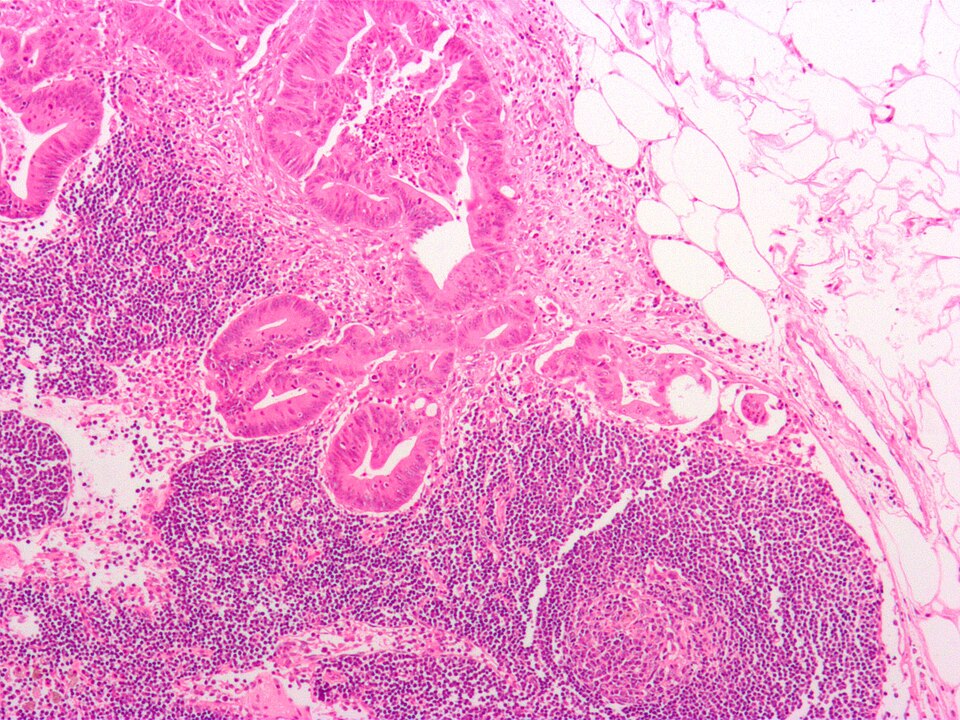 File:Crc met to node1.jpg