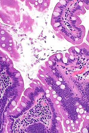 Giardia duodenum pathology. Giardia pathology outlines